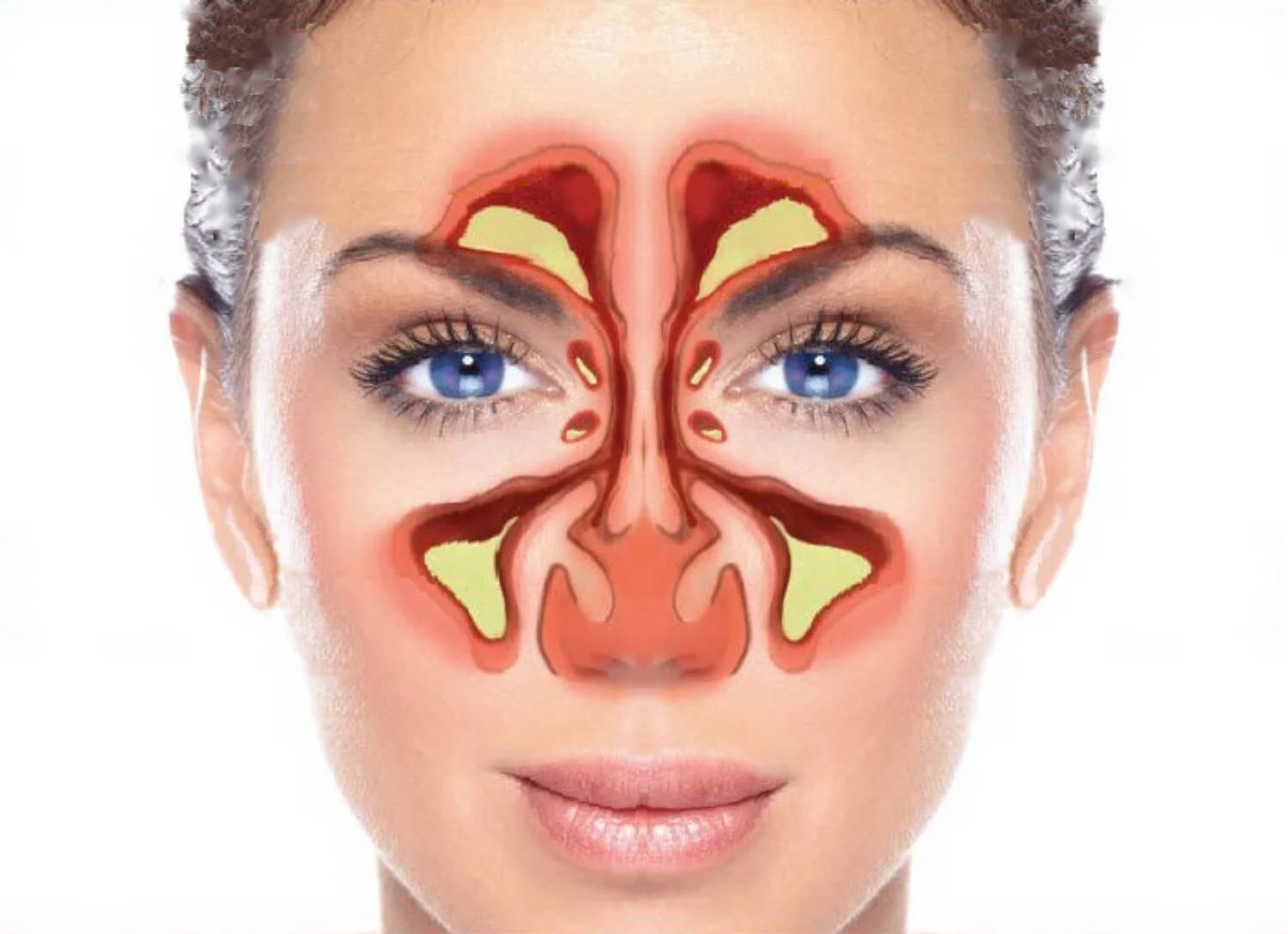 علاج الجيوب الأنفية وتخفيف اعراض صداع الجيوب الأنفية